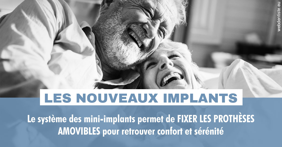 https://dr-laurence-choukroun-de-boerdere.chirurgiens-dentistes.fr/Les nouveaux implants 2