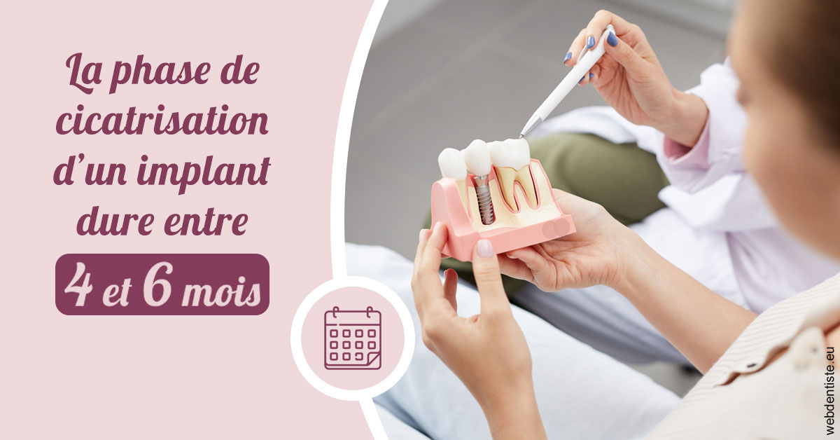 https://dr-laurence-choukroun-de-boerdere.chirurgiens-dentistes.fr/Cicatrisation implant 2