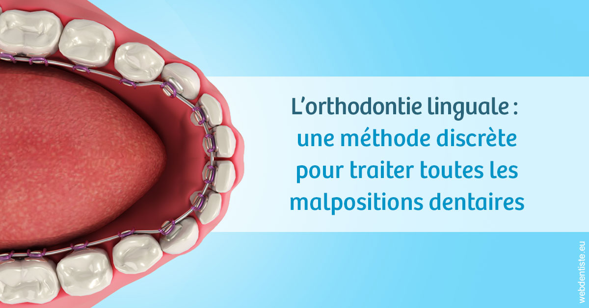 https://dr-laurence-choukroun-de-boerdere.chirurgiens-dentistes.fr/L'orthodontie linguale 1