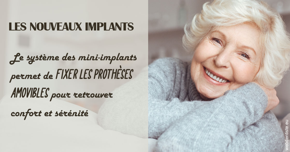 https://dr-laurence-choukroun-de-boerdere.chirurgiens-dentistes.fr/Les nouveaux implants 1