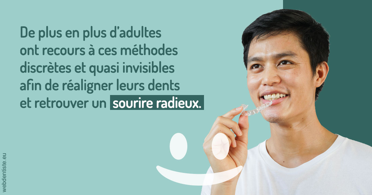 https://dr-laurence-choukroun-de-boerdere.chirurgiens-dentistes.fr/Gouttières sourire radieux 2