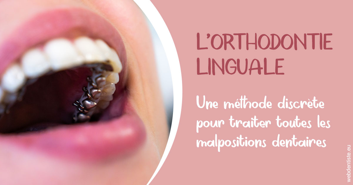 https://dr-laurence-choukroun-de-boerdere.chirurgiens-dentistes.fr/L'orthodontie linguale 2