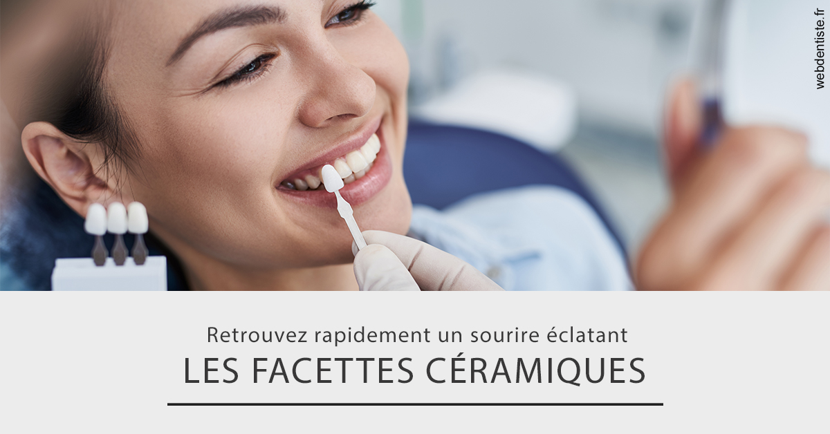 https://dr-laurence-choukroun-de-boerdere.chirurgiens-dentistes.fr/Les facettes céramiques 2