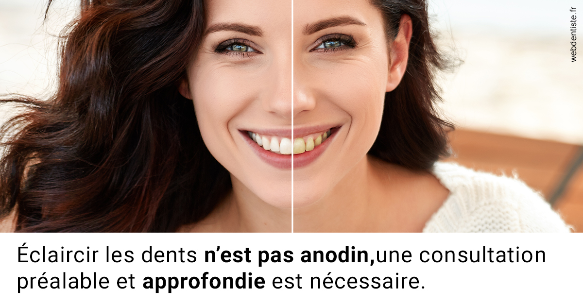 https://dr-laurence-choukroun-de-boerdere.chirurgiens-dentistes.fr/Le blanchiment 2