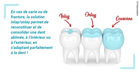 https://dr-laurence-choukroun-de-boerdere.chirurgiens-dentistes.fr/L'INLAY ou l'ONLAY