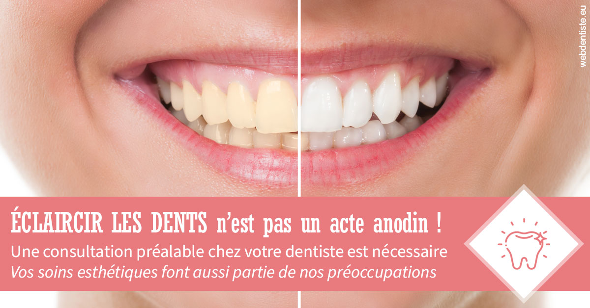 https://dr-laurence-choukroun-de-boerdere.chirurgiens-dentistes.fr/Eclaircir les dents 1