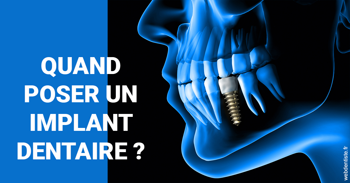https://dr-laurence-choukroun-de-boerdere.chirurgiens-dentistes.fr/Les implants 1