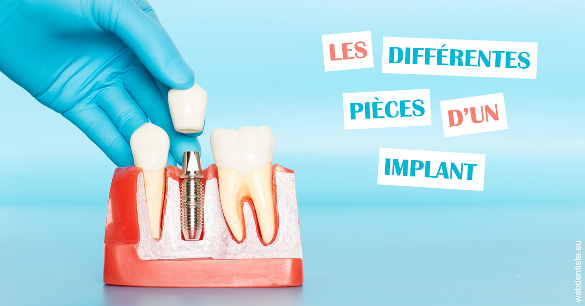 https://dr-laurence-choukroun-de-boerdere.chirurgiens-dentistes.fr/Les différentes pièces d’un implant 2