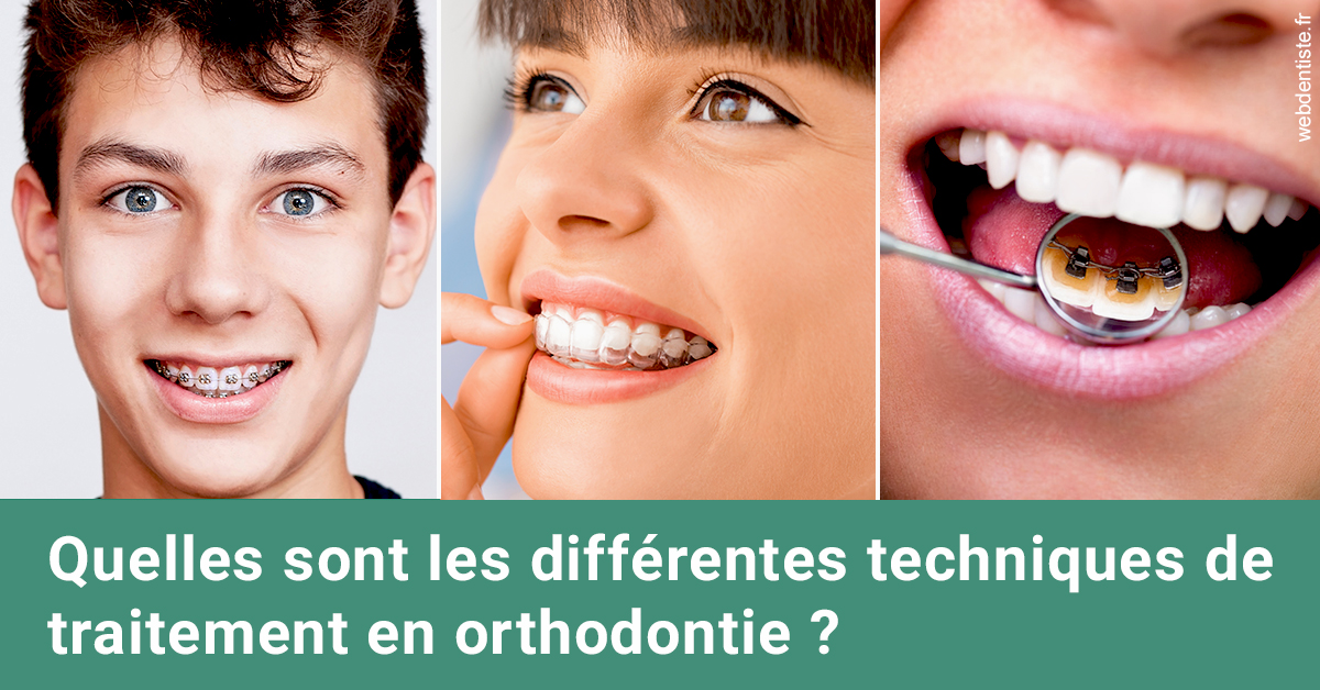 https://dr-laurence-choukroun-de-boerdere.chirurgiens-dentistes.fr/Les différentes techniques de traitement 2