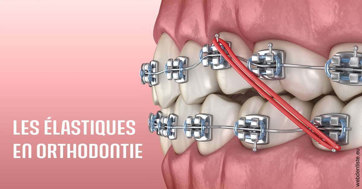 https://dr-laurence-choukroun-de-boerdere.chirurgiens-dentistes.fr/Elastiques orthodontie 2