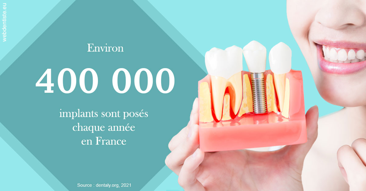 https://dr-laurence-choukroun-de-boerdere.chirurgiens-dentistes.fr/Pose d'implants en France 2